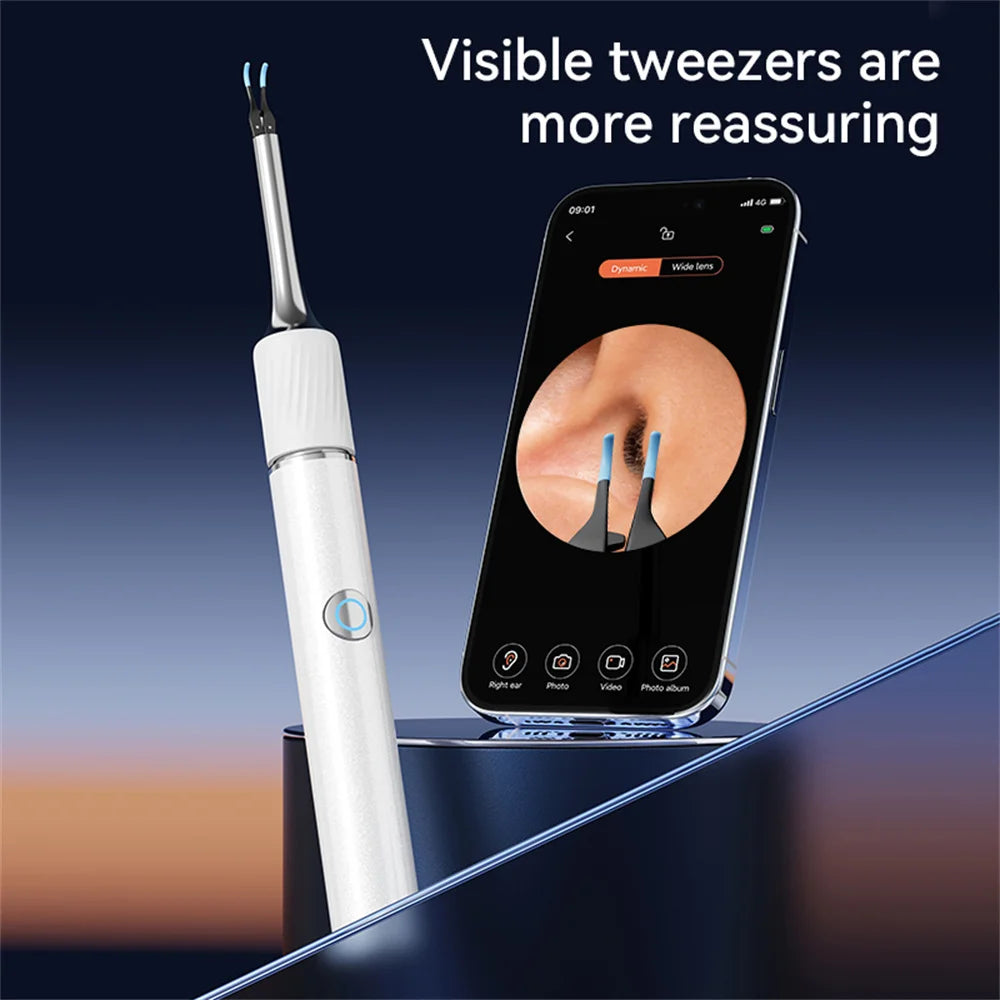 Ear Wax Removal Tool with 12MP Camera