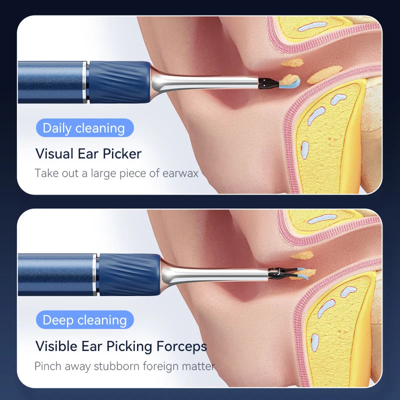 Ear Wax Removal Tool with 12MP Camera