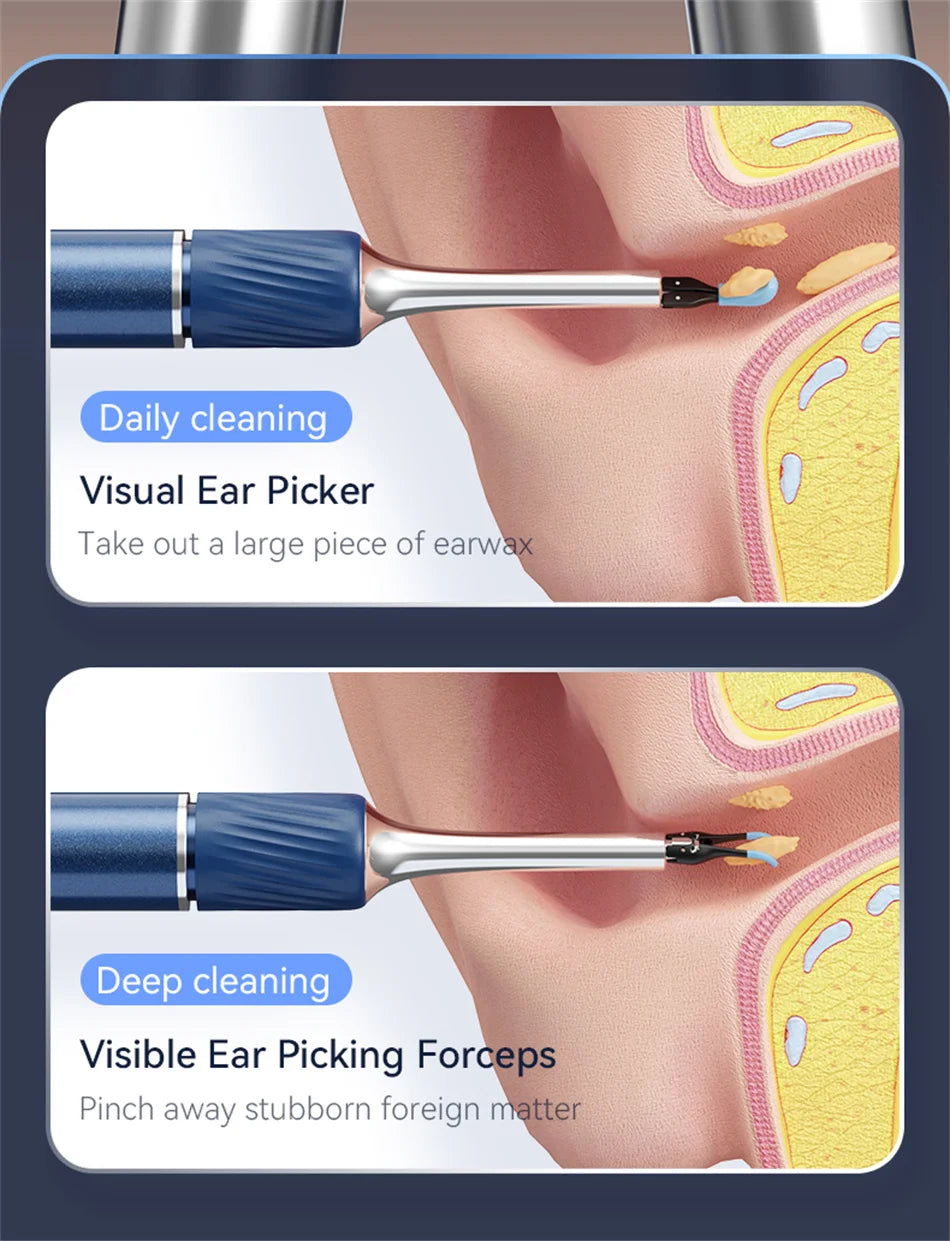 Ear Wax Removal Tool with 12MP Camera